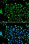 NCOR1 antibody, LS-C346203, Lifespan Biosciences, Immunofluorescence image 