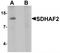 Succinate dehydrogenase assembly factor 2, mitochondrial antibody, TA319947, Origene, Western Blot image 