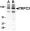 Transient Receptor Potential Cation Channel Subfamily C Member 3 antibody, NBP1-77262, Novus Biologicals, Western Blot image 