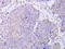 Mitogen-Activated Protein Kinase Kinase 1 antibody, AP20956PU-N, Origene, Immunohistochemistry paraffin image 