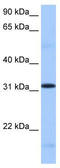 Serine And Arginine Rich Splicing Factor 10 antibody, TA343969, Origene, Western Blot image 
