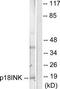 Cyclin Dependent Kinase Inhibitor 2C antibody, TA313181, Origene, Western Blot image 