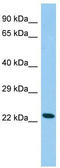 Cysteine Dioxygenase Type 1 antibody, TA340024, Origene, Western Blot image 