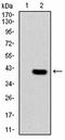 Integrin Subunit Beta 2 antibody, orb156298, Biorbyt, Western Blot image 