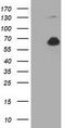 Pyruvate Kinase L/R antibody, TA501414, Origene, Western Blot image 