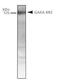 Gamma-Aminobutyric Acid Type B Receptor Subunit 2 antibody, TA336615, Origene, Western Blot image 