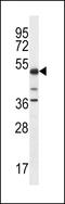 Proline-serine-threonine phosphatase-interacting protein 1 antibody, LS-C162259, Lifespan Biosciences, Western Blot image 
