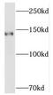 Structural Maintenance Of Chromosomes 3 antibody, FNab08017, FineTest, Western Blot image 