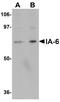 INSM Transcriptional Repressor 2 antibody, A14973, Boster Biological Technology, Western Blot image 