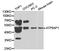ATPase H+ Transporting Accessory Protein 1 antibody, TA326997, Origene, Western Blot image 