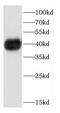CD8b Molecule antibody, FNab01506, FineTest, Western Blot image 