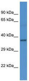 Rabphilin 3A antibody, TA342635, Origene, Western Blot image 