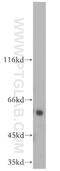 ETS Transcription Factor ELK1 antibody, 14507-1-AP, Proteintech Group, Western Blot image 