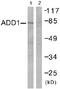 Adducin 1 antibody, ab51130, Abcam, Western Blot image 
