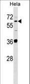 Sulfite Oxidase antibody, LS-C161617, Lifespan Biosciences, Western Blot image 