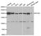 Rho Associated Coiled-Coil Containing Protein Kinase 2 antibody, TA332851, Origene, Western Blot image 