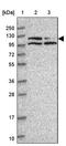 Serine/threonine-protein phosphatase 1 regulatory subunit 10 antibody, PA5-61475, Invitrogen Antibodies, Western Blot image 