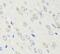 CRABP-II antibody, FNab01951, FineTest, Immunohistochemistry paraffin image 