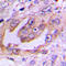 Kinesin-like protein KIF11 antibody, LS-C356147, Lifespan Biosciences, Immunohistochemistry paraffin image 