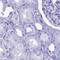 Plasma cell-induced resident endoplasmic reticulum protein antibody, NBP1-92287, Novus Biologicals, Immunohistochemistry paraffin image 