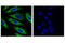 Keratin 17 antibody, 12509S, Cell Signaling Technology, Immunocytochemistry image 