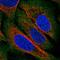 Zinc Finger DHHC-Type Containing 22 antibody, HPA072213, Atlas Antibodies, Immunofluorescence image 