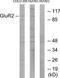Glutamate Ionotropic Receptor AMPA Type Subunit 2 antibody, TA313965, Origene, Western Blot image 