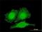 Zyxin antibody, H00007791-M01, Novus Biologicals, Immunofluorescence image 