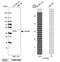 Shiftless Antiviral Inhibitor Of Ribosomal Frameshifting antibody, PA5-59815, Invitrogen Antibodies, Western Blot image 