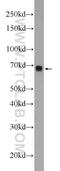 Forkhead Box D4 antibody, 24835-1-AP, Proteintech Group, Western Blot image 