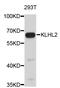 Kelch Like Family Member 2 antibody, abx003369, Abbexa, Western Blot image 