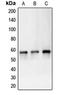 Carbonic Anhydrase 9 antibody, LS-B15818, Lifespan Biosciences, Western Blot image 