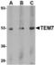 Plexin Domain Containing 1 antibody, TA306474, Origene, Western Blot image 