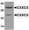 CXXC Finger Protein 5 antibody, orb75545, Biorbyt, Western Blot image 