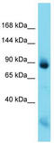 Nfm antibody, TA331276, Origene, Western Blot image 