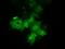 Cilia And Flagella Associated Protein 298 antibody, GTX84745, GeneTex, Immunofluorescence image 