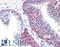 DNA repair protein XRCC3 antibody, LS-C140845, Lifespan Biosciences, Immunohistochemistry paraffin image 