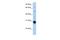 Nuclear Receptor Subfamily 0 Group B Member 2 antibody, A03866, Boster Biological Technology, Western Blot image 