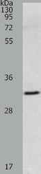 Matrix Metallopeptidase 26 antibody, TA322219, Origene, Western Blot image 