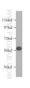 Splicing Factor 3a Subunit 3 antibody, 12070-1-AP, Proteintech Group, Western Blot image 