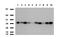 CD32a antibody, LS-C796733, Lifespan Biosciences, Western Blot image 