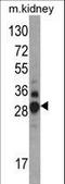 Dimethylarginine Dimethylaminohydrolase 1 antibody, LS-C167312, Lifespan Biosciences, Western Blot image 