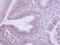 Coatomer subunit beta antibody, NBP2-15577, Novus Biologicals, Immunohistochemistry frozen image 