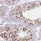 Mitochondrial Ribosomal Protein L34 antibody, HPA049276, Atlas Antibodies, Immunohistochemistry paraffin image 