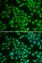 Deoxycytidine Kinase antibody, 18-165, ProSci, Immunofluorescence image 
