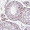 CCCTC-Binding Factor antibody, AMAb90664, Atlas Antibodies, Immunohistochemistry paraffin image 
