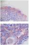 Platelet-derived growth factor subunit A antibody, PP1061P2, Origene, Immunohistochemistry frozen image 