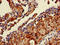 Capping Actin Protein Of Muscle Z-Line Subunit Alpha 2 antibody, LS-C369358, Lifespan Biosciences, Immunohistochemistry paraffin image 