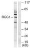 RCC1 And BTB Domain Containing Protein 1 antibody, abx013186, Abbexa, Western Blot image 