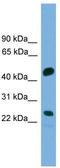 Cell Division Cycle Associated 4 antibody, TA339730, Origene, Western Blot image 